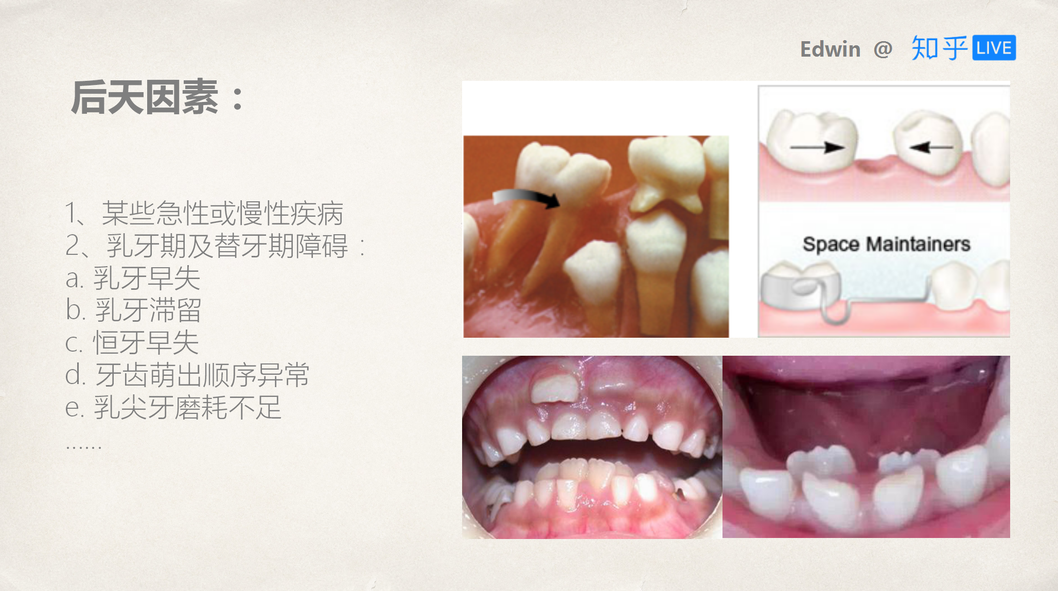 牙齒窩溝封閉是什么意思,牙齒窩溝封閉與互動策略評估，一次全面的探討,實(shí)踐性策略實(shí)施_錢包版27.36.77