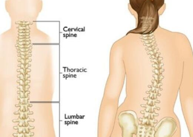 如何自測(cè)孩子是否脊柱側(cè)彎